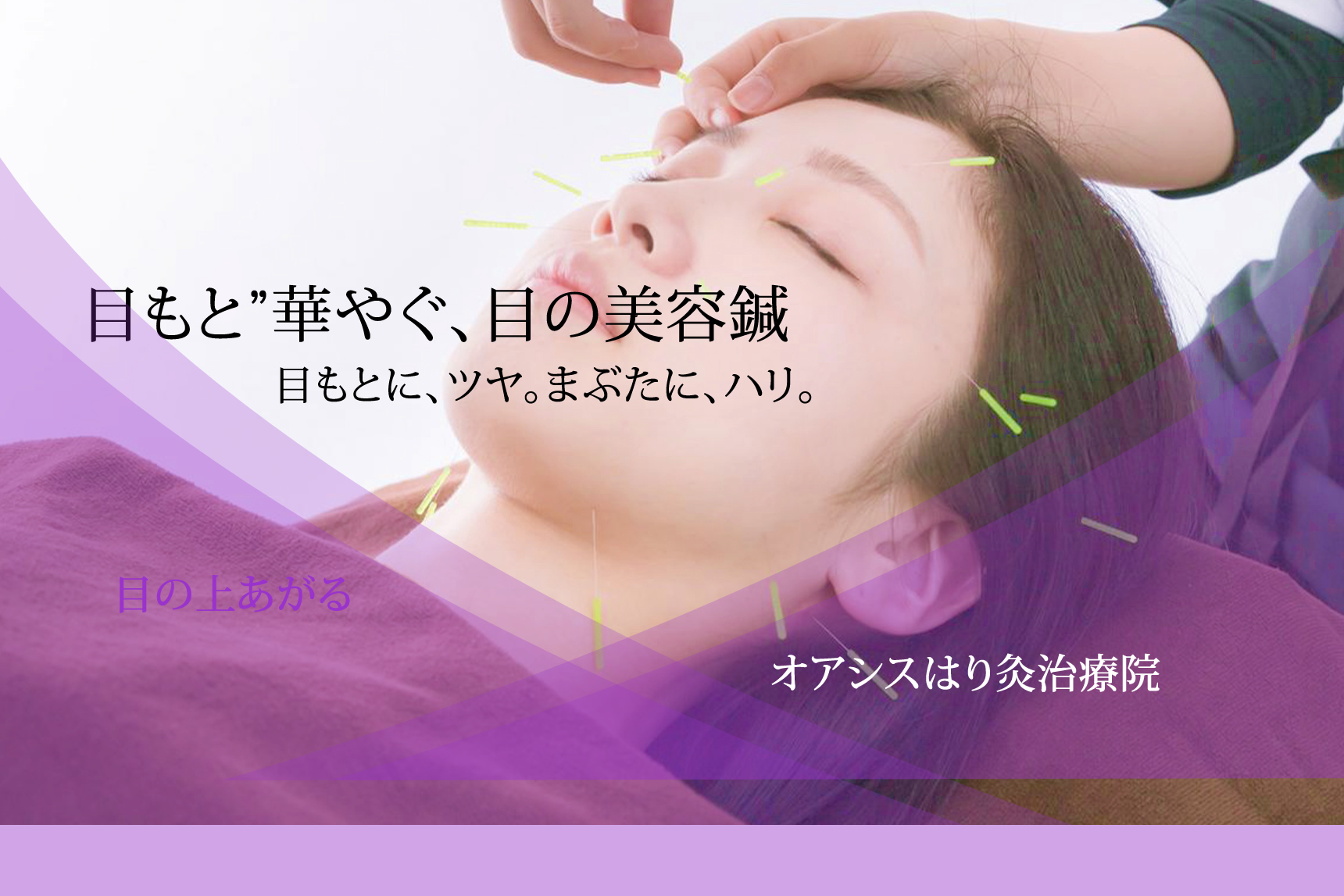“目もと”華やぐ、目の美容鍼。目もとに、ツヤ。まぶたに、ハリ。