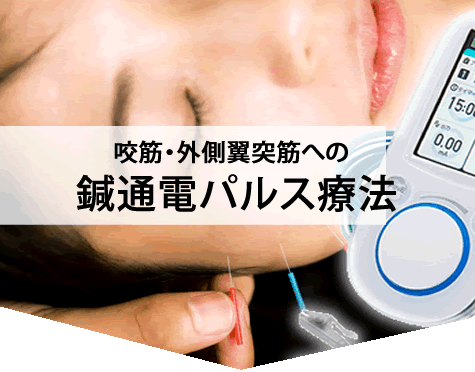 咬筋・外側翼突筋への鍼通電パルス療法、ピコリナの写真