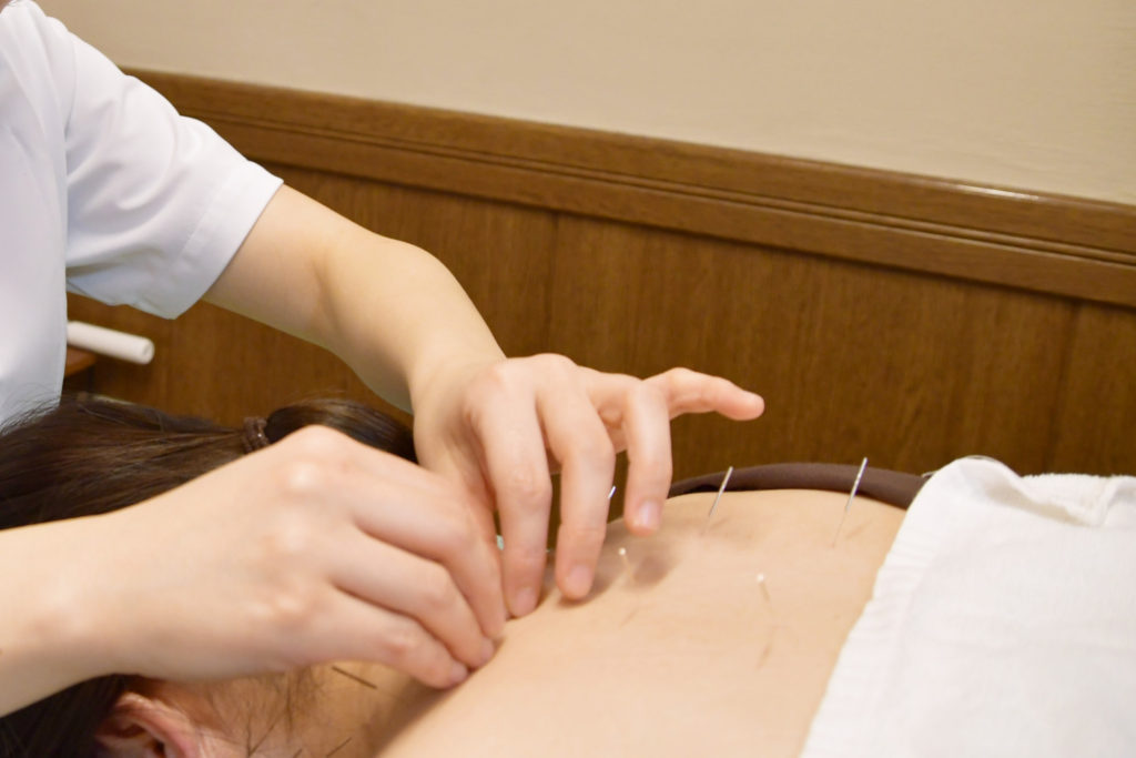背中への鍼