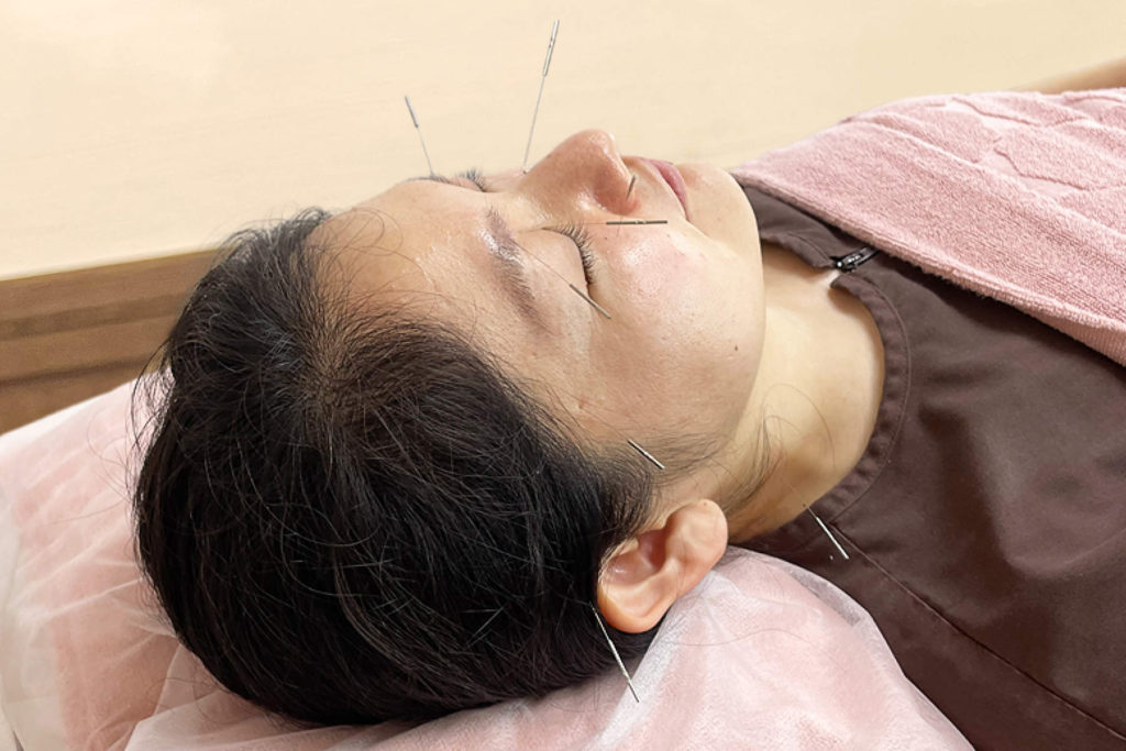 東洋医学的アプローチ