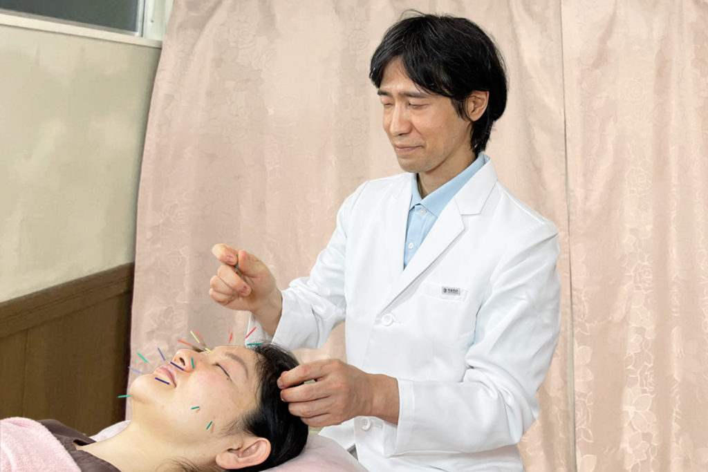顔の鍼
