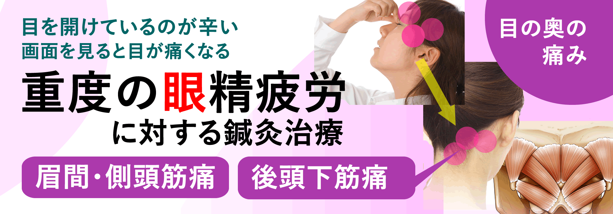 目の奥の痛み、眉間こめかみ痛、重度の眼精疲労への鍼灸治療のご案内